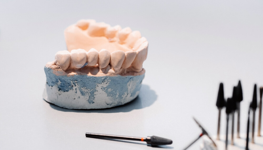 Custom Dental Prosthesis: Enhancing Patient Care with Precision and Technology
