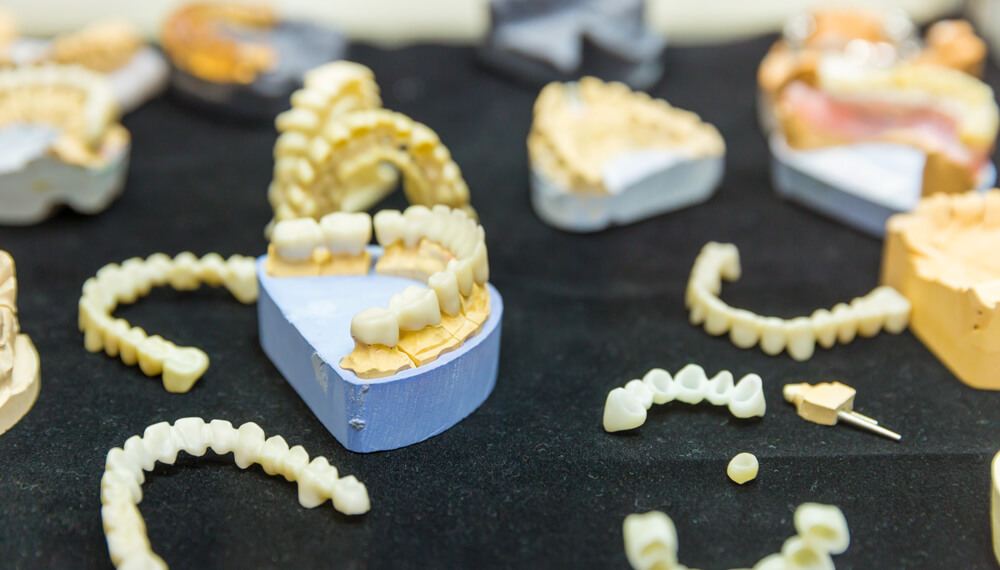Full Gold Dental Prosthetics: A Timeless Choice for Durability and Aesthetics