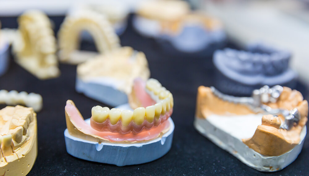 Custom Dental Implant Abutments: Enhancing Precision and Functionality